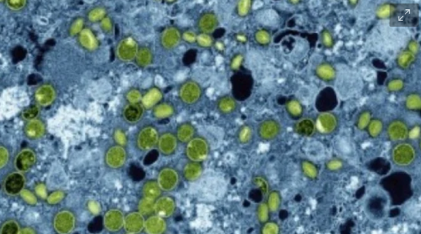 La OMS notifica 19 casos y cuatro muertes por MERS-CoV en el mundo en 2025