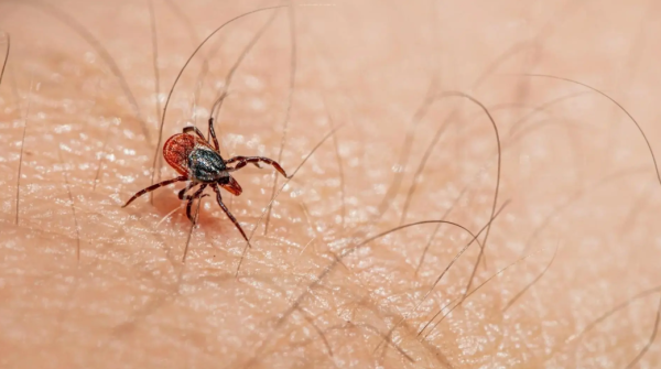 Se tienen 8 defunciones por rickettsiosis en la ciudad de Chihuahua: IMPAS