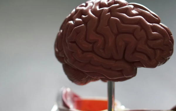 Infartos cerebrales impactan a mexicanos cada vez más jóvenes, alerta especialista
