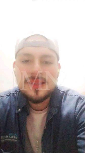 Joven fue rociado con gasolina y quemado por motociclistas el sábado pasado