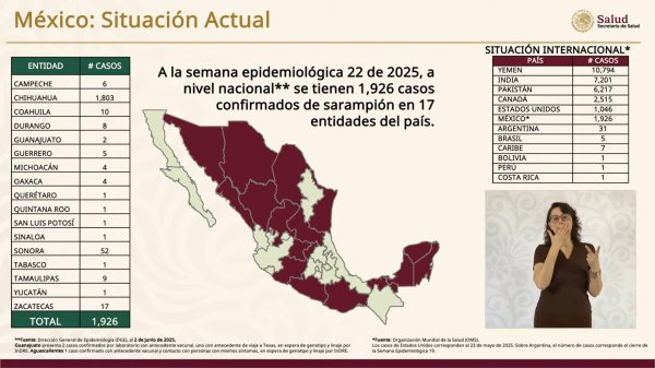 Chihuahua, con mil 803 de los mil 926 casos confirmados de sarampión:SS