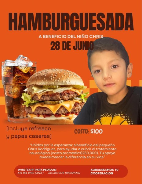 Invitan a hamburguesada con causa en beneficio de Chris; requiere tratamiento neurológico