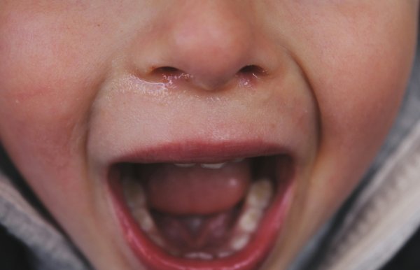 Los niños con arrebatos emocionales tienen más posibilidades de depresión de adolescentes