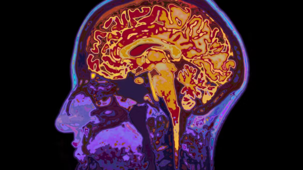 ¿Qué pasa en el cerebro cuando “caemos en la tentación”? Neurociencia de la corrupción política