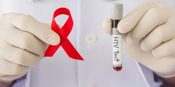 Solicitan atender a la población con VIH-Sida
