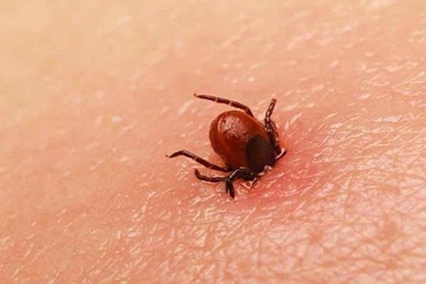 Perdieron la vida 9 personas por rickettsiosis: SSE
