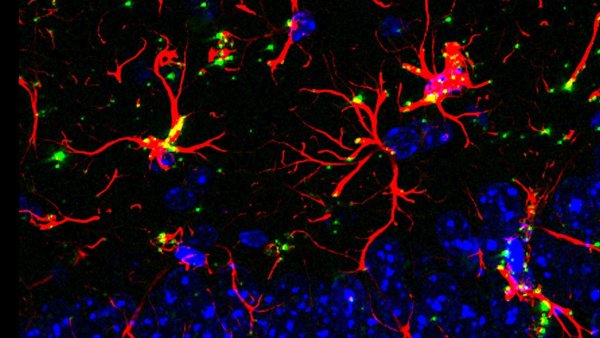 Una molécula natural podría ofrecer nuevas esperanzas en la lucha contra el alzhéimer
