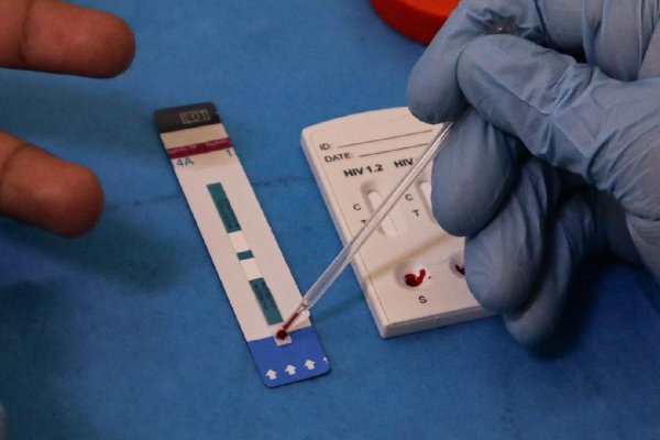 Diagnóstico tardío en 40 % de los casos de VIH; Red de Respuesta busca cerrar brecha en prevención y atención