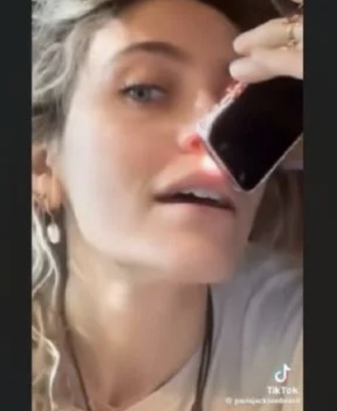 París Jackson admite que la adicción le provocó a su nariz este daño (Video)