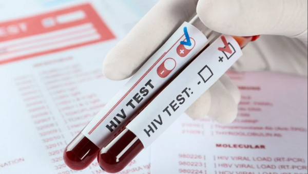 México identificó más de 15 mil casos nuevos de VIH durante 2025