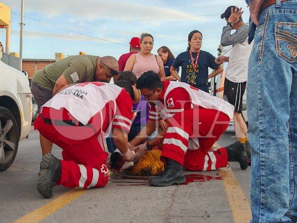 Arrollan a adulto mayor en la 20 de Noviembre; queda grave