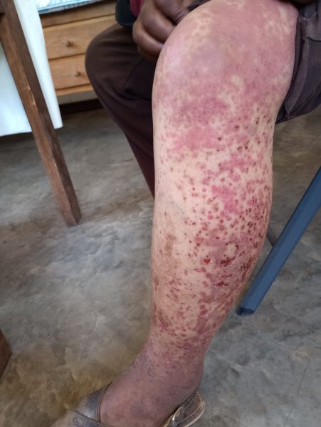 Denuncian falta de médicos en Baborigame