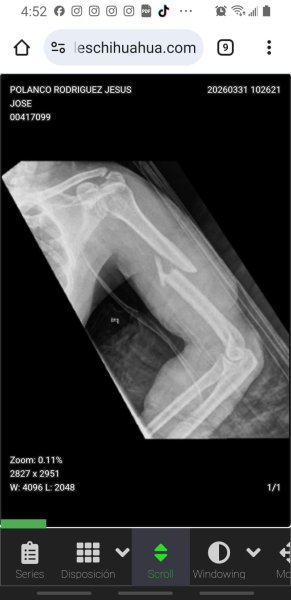 Piden apoyo urgente para salvar la vida de Jesús tras grave accidente en motocicleta