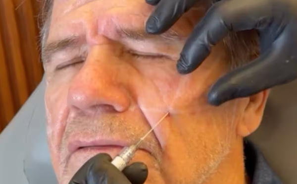 Exalcalde de Macuspana reaparece tras salir de prisión y presume bótox: ‘Van a ver a este muñeco’