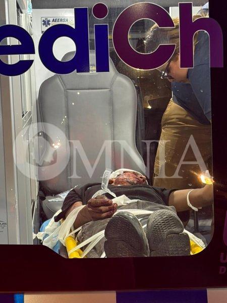 Joven de 20 años resulta gravemente herido tras presunta golpiza en Punta Oriente