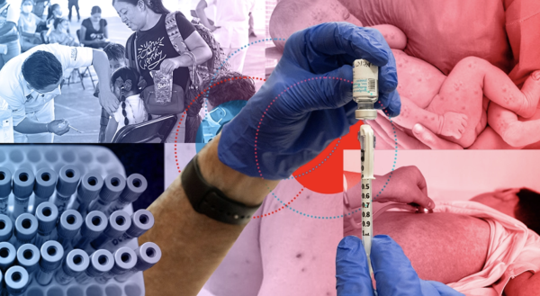 Bebé muere por complicaciones de sarampión en Tlaxcala; suman más de 20 defunciones en México