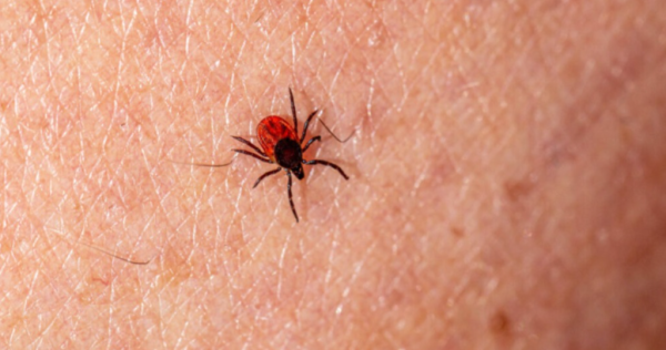 Aumentan las defunciones por rickettsiosis en el estado: SSE