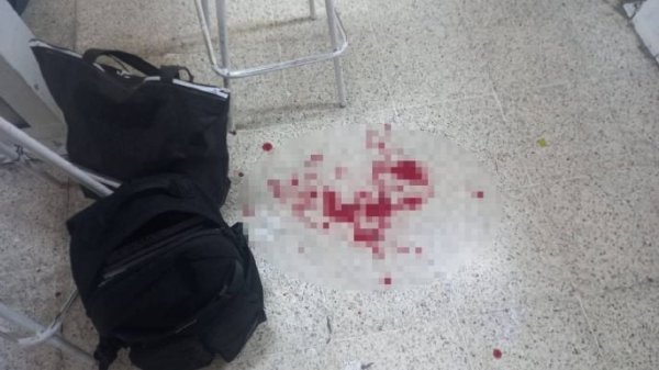 Alumno apuñala a maestro en secundaria de Huimanguillo, Tabasco; lo reportan grave