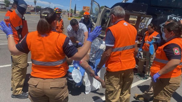 Coordina SSPE traslado aeromédico de paciente con quemaduras